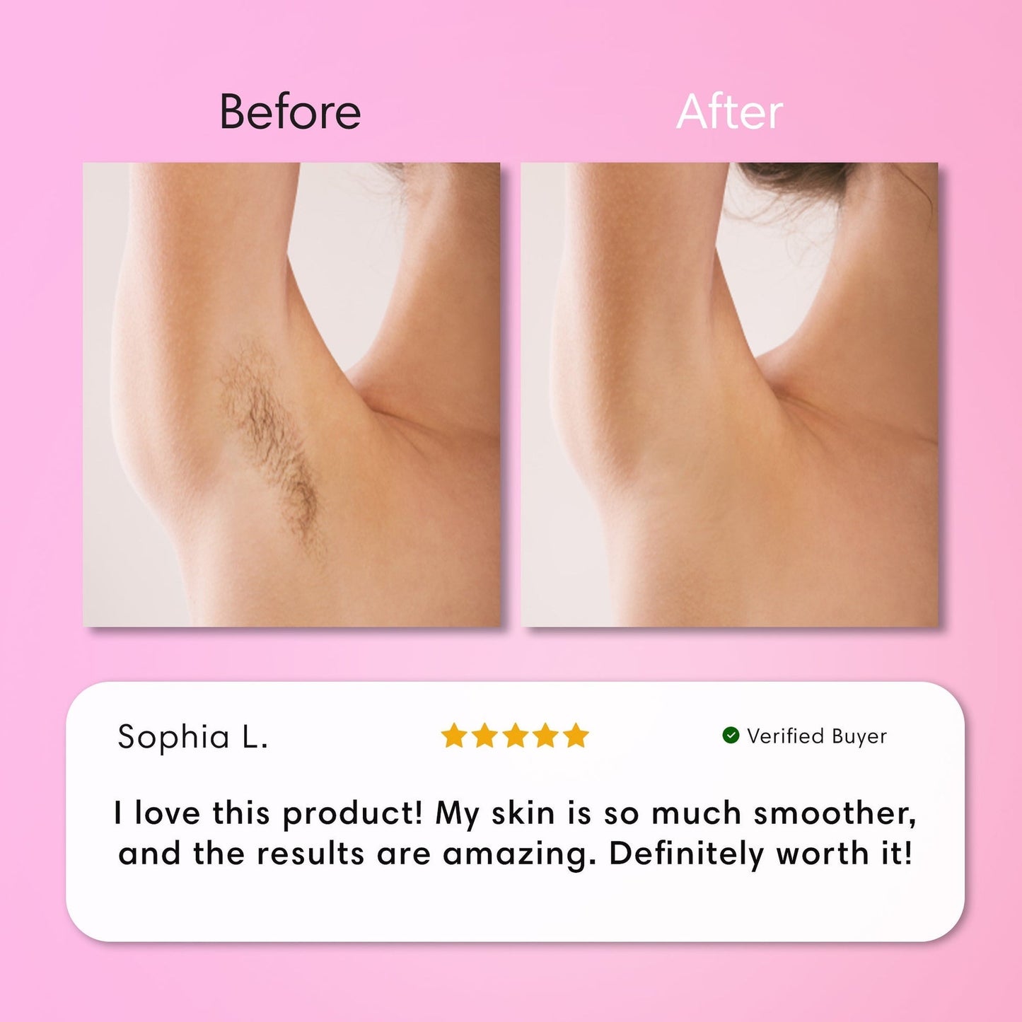 Starpositive Hair Removal Cream | Gentle 5-Minute Body Hair Removal