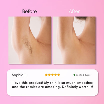 Starpositive Hair Removal Cream | Gentle 5-Minute Body Hair Removal