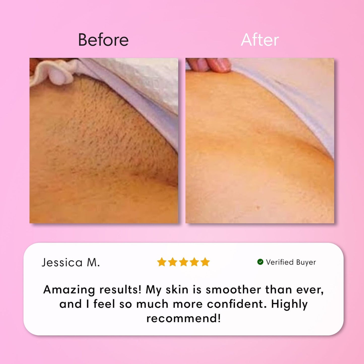 Starpositive Hair Removal Cream | Gentle 5-Minute Body Hair Removal