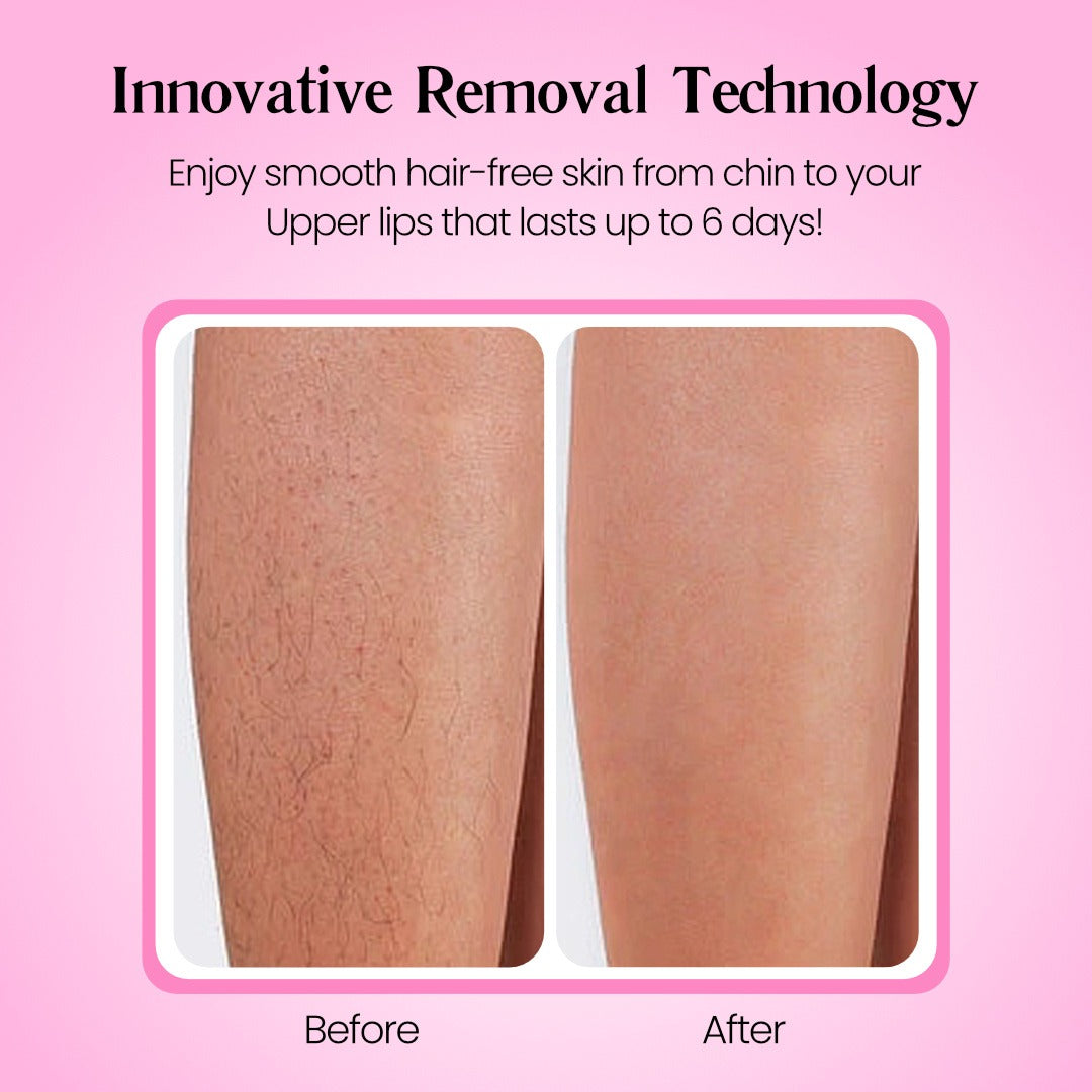 Starpositive Hair Removal Cream | Gentle 5-Minute Body Hair Removal