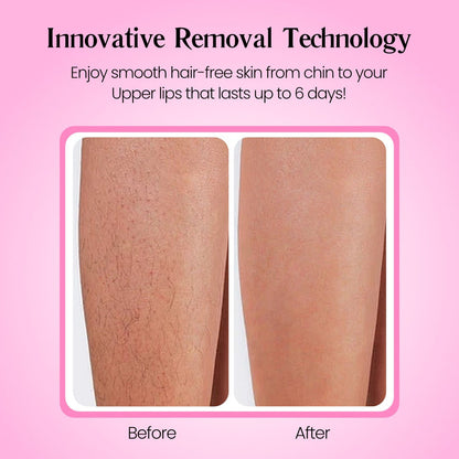 Starpositive Hair Removal Cream | Gentle 5-Minute Body Hair Removal