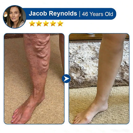 Before and after result