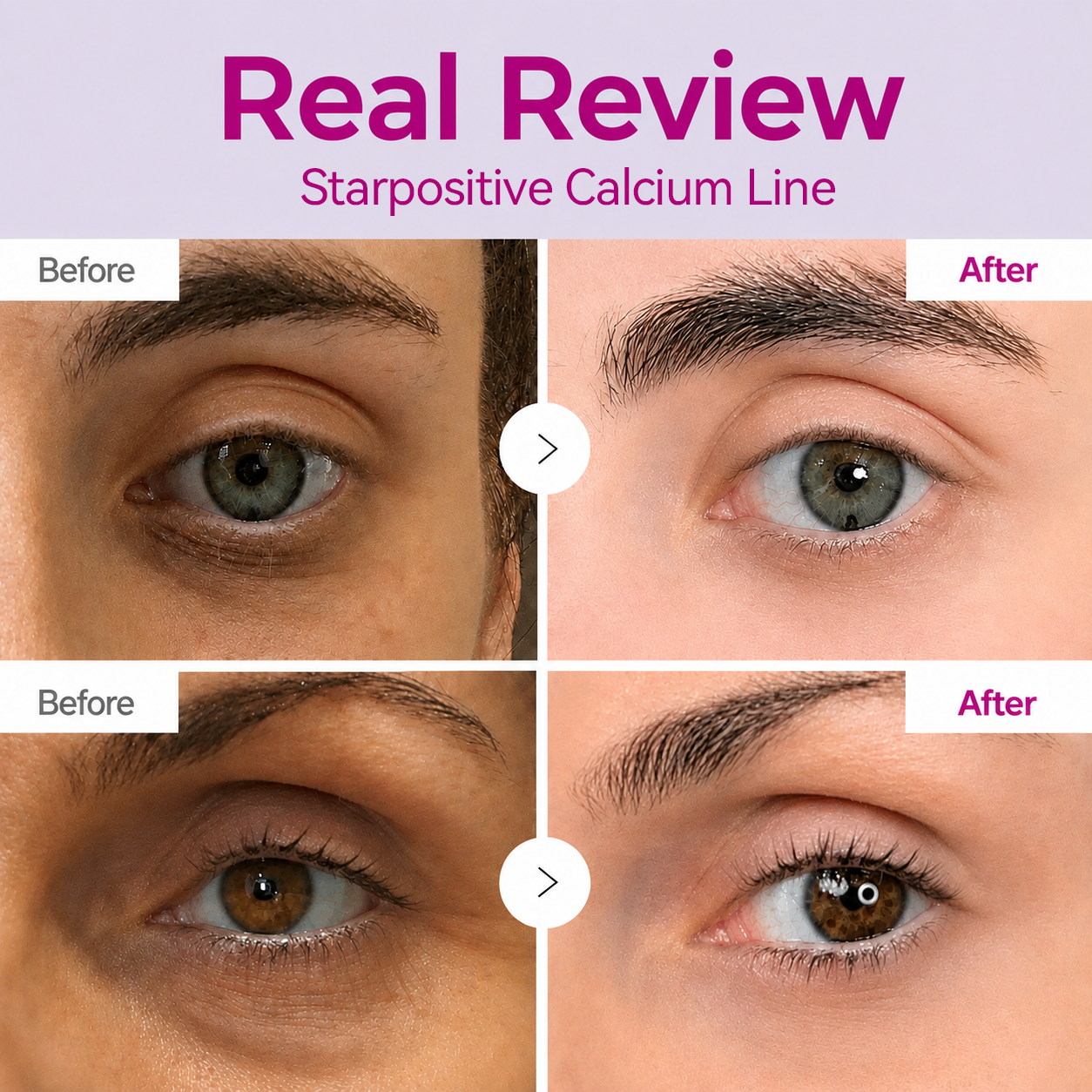 🔥LAST DAY 50% OFF!!Starpositive Korean Calcium Dark Spot Eye Cream