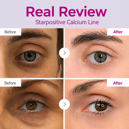 🔥LAST DAY 50% OFF!!Starpositive Korean Calcium Dark Spot Eye Cream