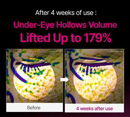 🔥LAST DAY 50% OFF!!Starpositive Korean Calcium Dark Spot Eye Cream