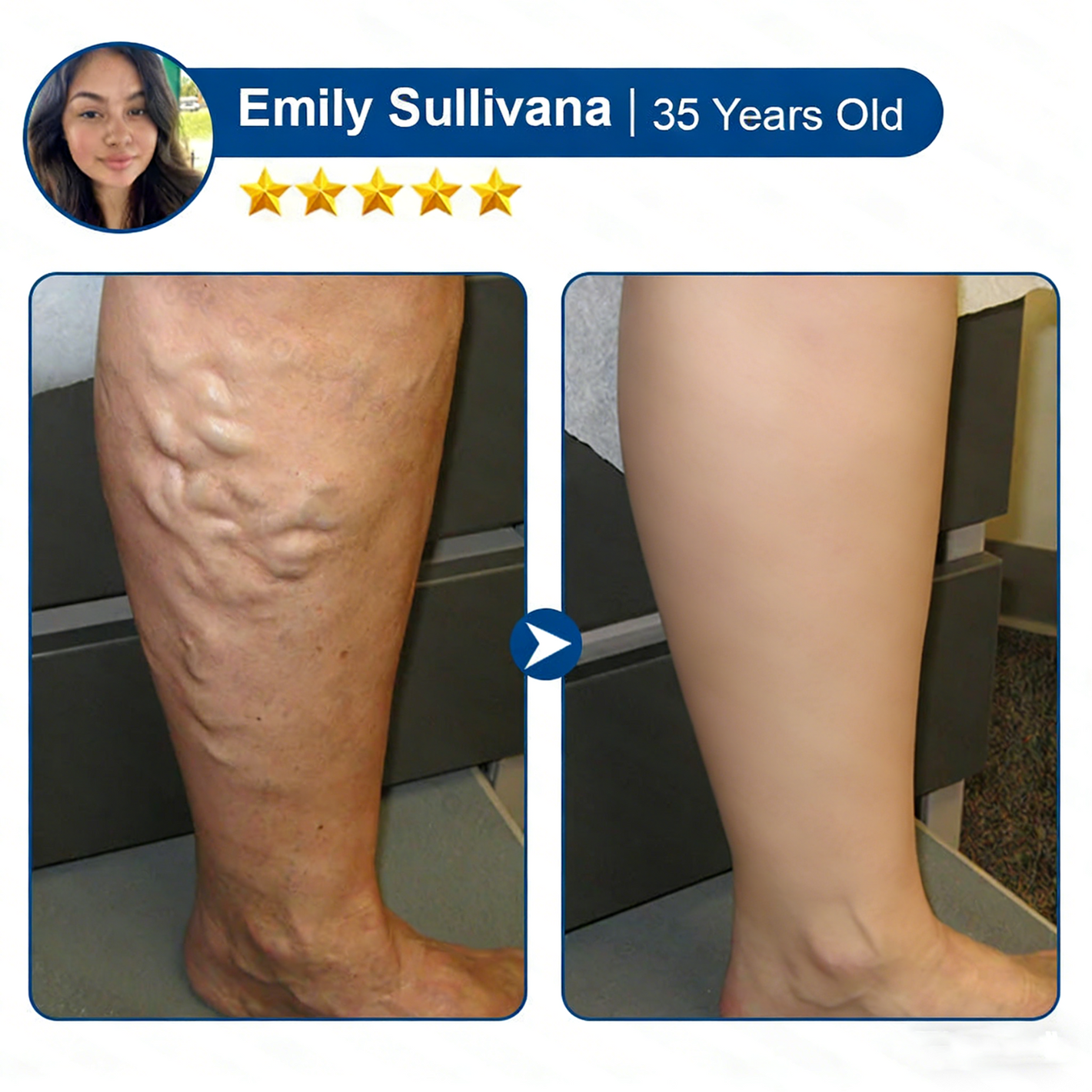 User before and after